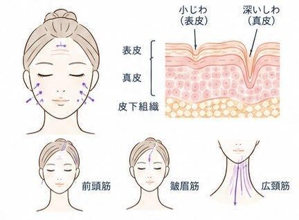 しわ治療
