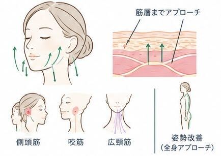 たるみ治療