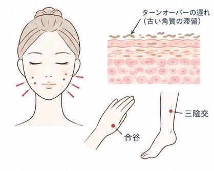 くすみ