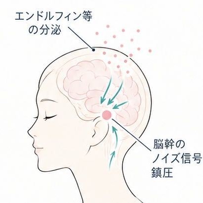 脳幹ノイズ信号鎮圧の図